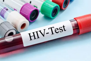 Dhjetë raste të reja me HIV në muajt e fundit, dy viktima – rritet testimi vullnetar