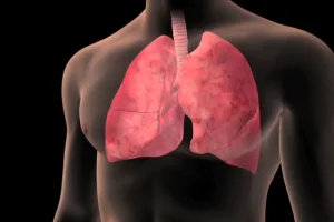 Mjekët rrëzojnë mitet për tuberkulozin: Jo çdo kollë është shenjë e sëmundjes