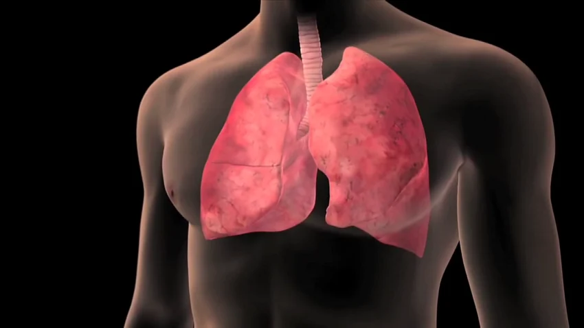 Mjekët rrëzojnë mitet për tuberkulozin: Jo çdo kollë është shenjë e sëmundjes