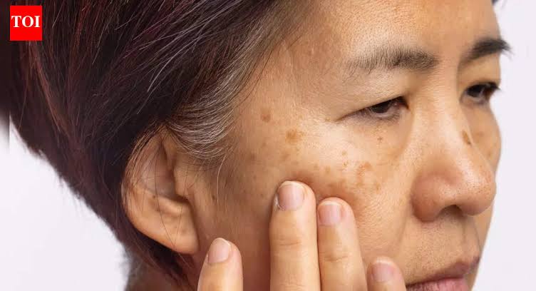 Shenjat që mund të tregojnë mungesë të vitaminës B12
