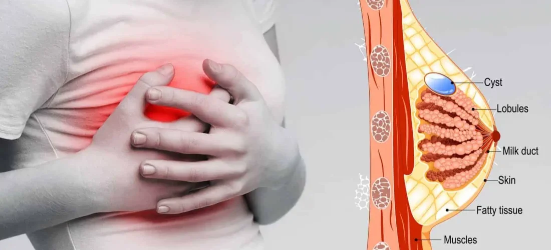Dhimbja e gjirit: Kur është e zakonshme dhe kur duhet kontrolluar?