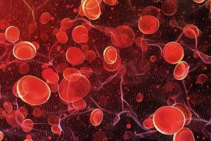 Hiponatremia: Çfarë ndodh kur niveli i natriumit në gjak bie?