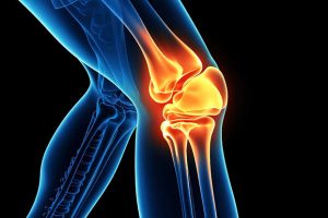 Osteoporoza: Si ta mbrojmë shëndetin e kockave?