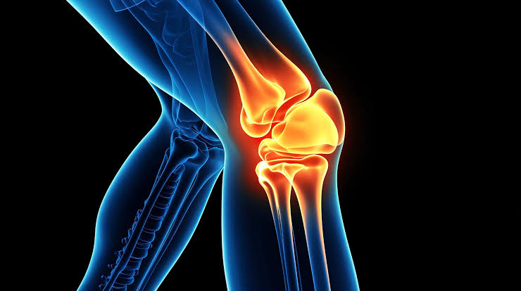 Osteoporoza: Si ta mbrojmë shëndetin e kockave?