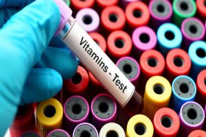 A është e nevojshme të bëjmë analiza vitaminash çdo vit?