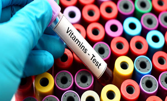 A është e nevojshme të bëjmë analiza vitaminash çdo vit?