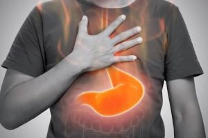 Refluksi gastrik: cilat ushqime dhe zakone mund t’i përkeqësojnë simptomat?