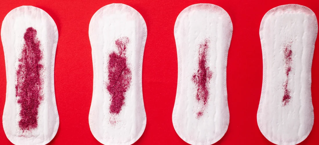 Kur është gjakderdhja menstruale më e madhe se normalja?